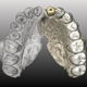 Virtual reconstruction of the jaw. The transparent side is a mirror image of the preserved portion. (Image: Gerhard Weber, University of Vienna)